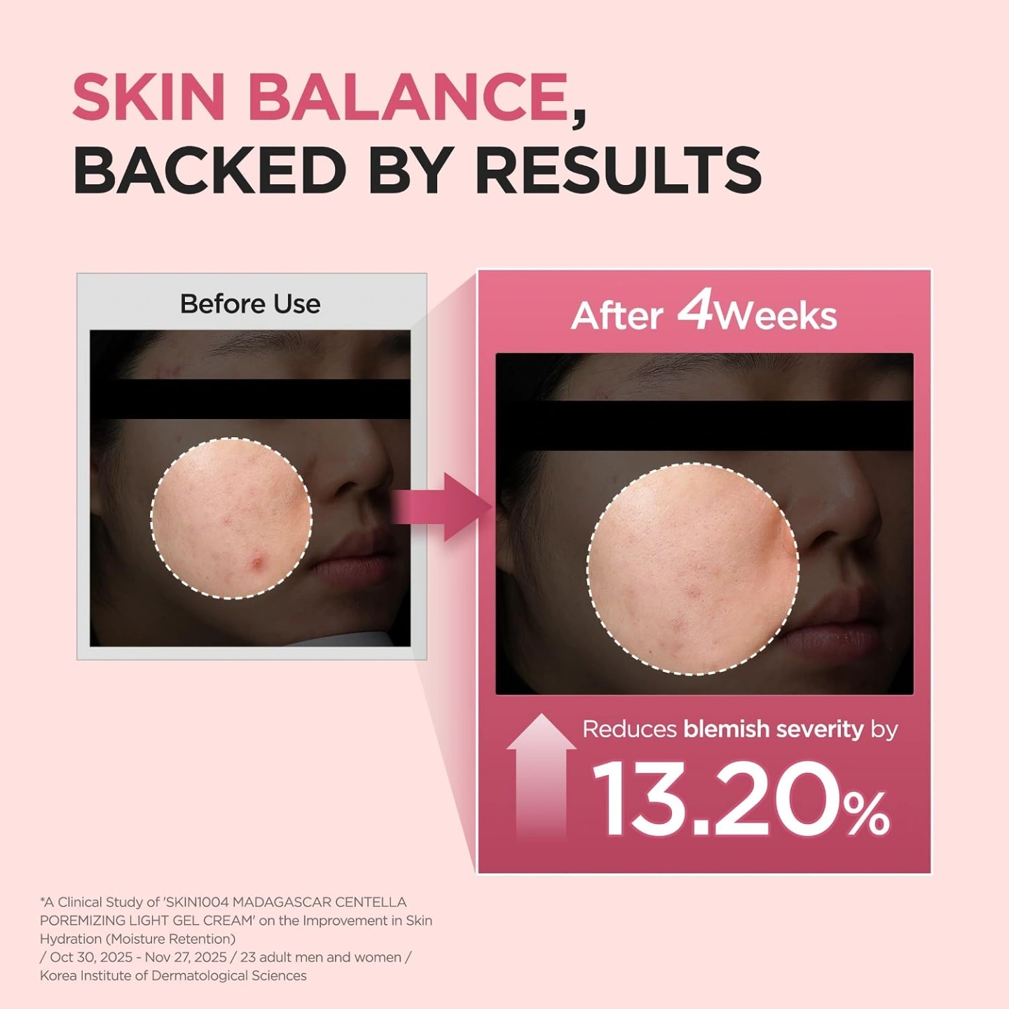 Skin1004 Centella Poremizing Light Gel Cream, 75ml 7