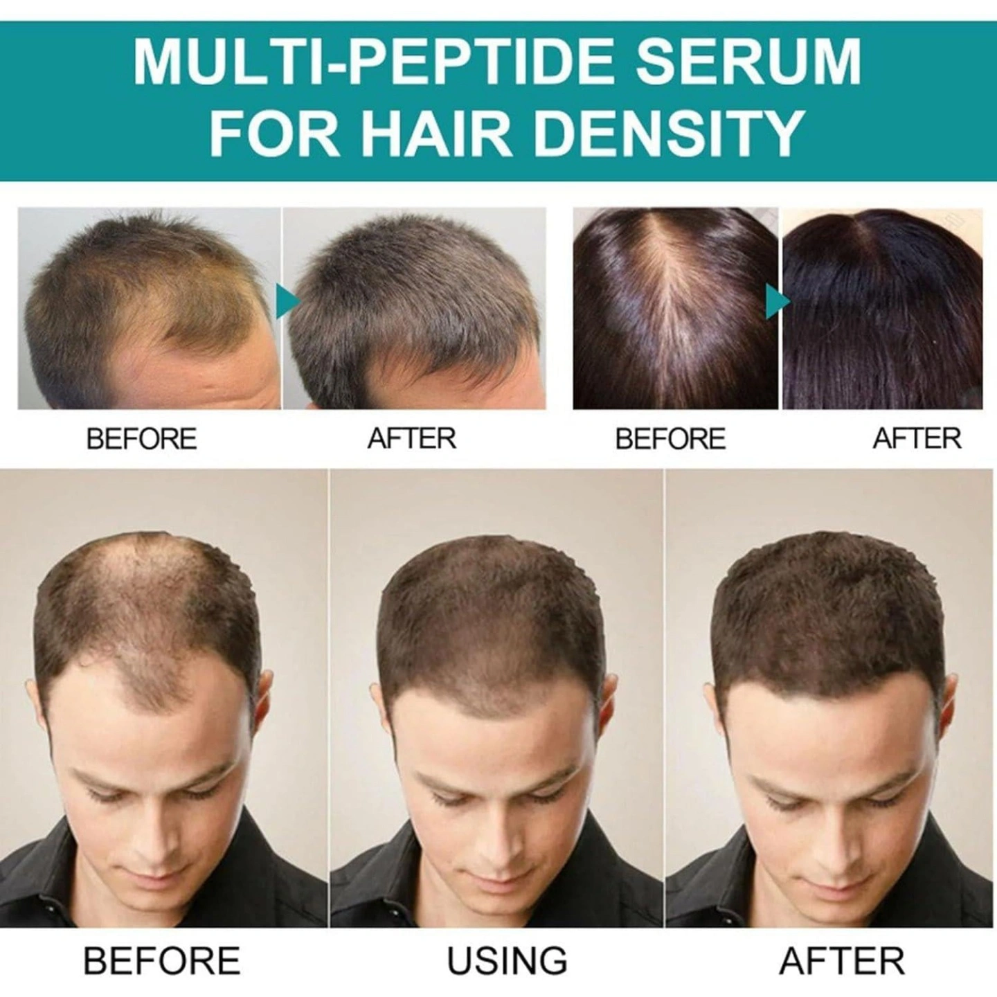 The Ordinary Multi-Peptide Serum for Hair Density - 60ML ( Canada ) 5