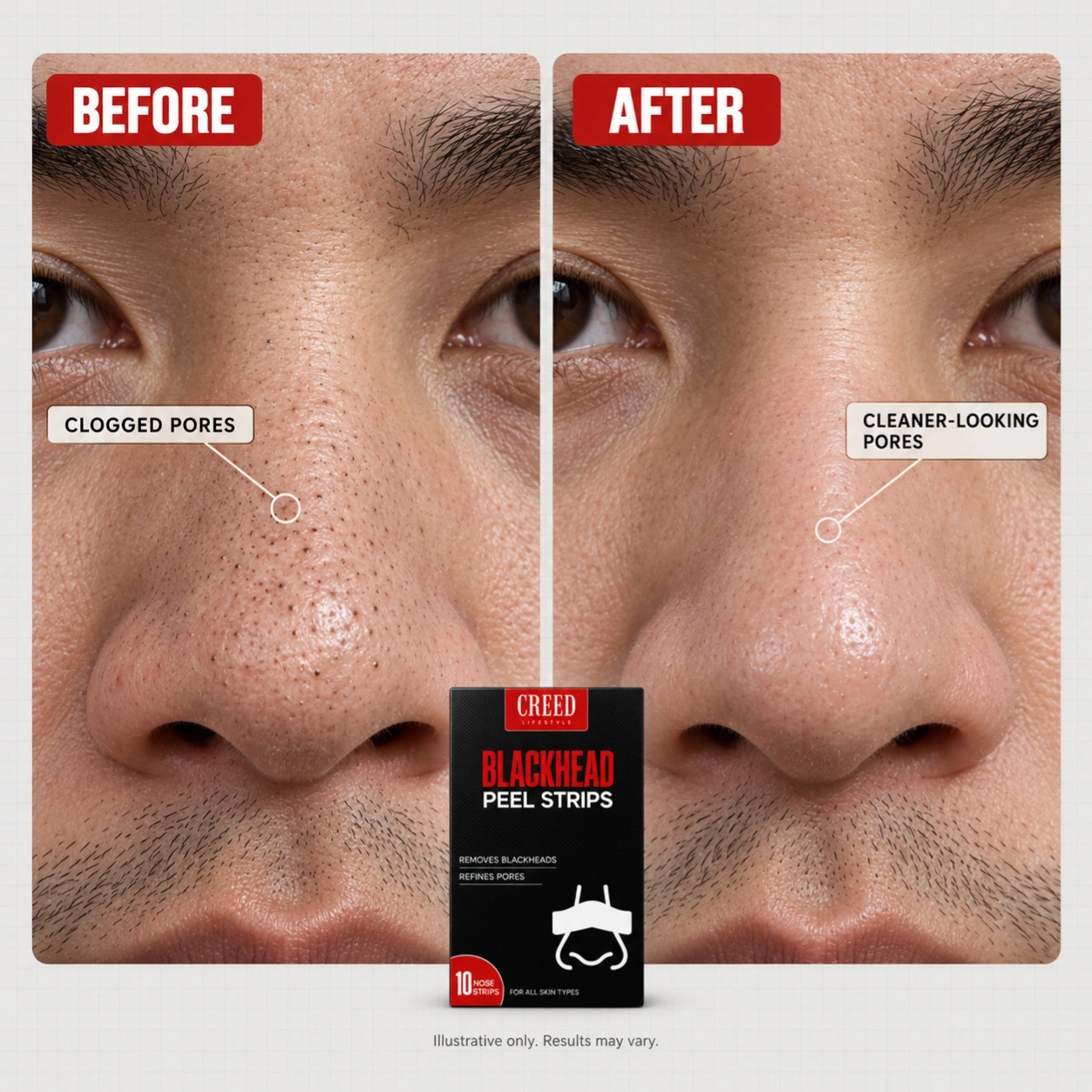 Blackhead Peel Strips 2
